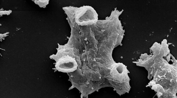 Negleria fowlera, insan yaşamı için tehlikeli bir protozoon parazitidir. 